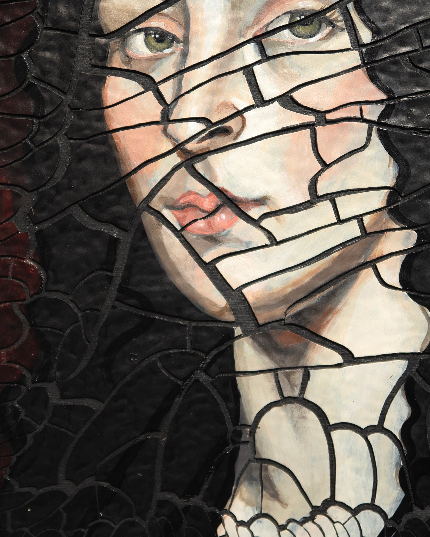 Fracture